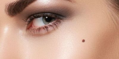 Cô bé bán nước mía và nốt ruồi sát chồng